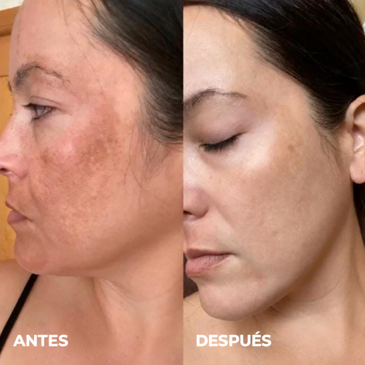 Crema Aclarante Luz Nativa® - Recupera la luminosidad de tu piel