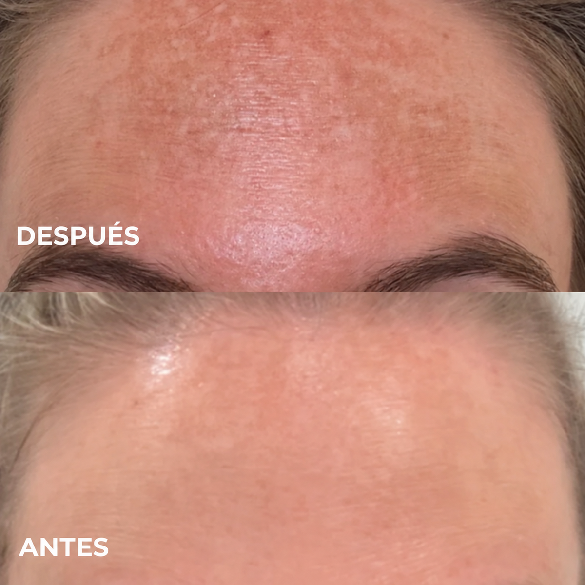 Crema Aclarante Luz Nativa® - Recupera la luminosidad de tu piel
