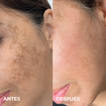 Crema Aclarante Luz Nativa® - Recupera la luminosidad de tu piel